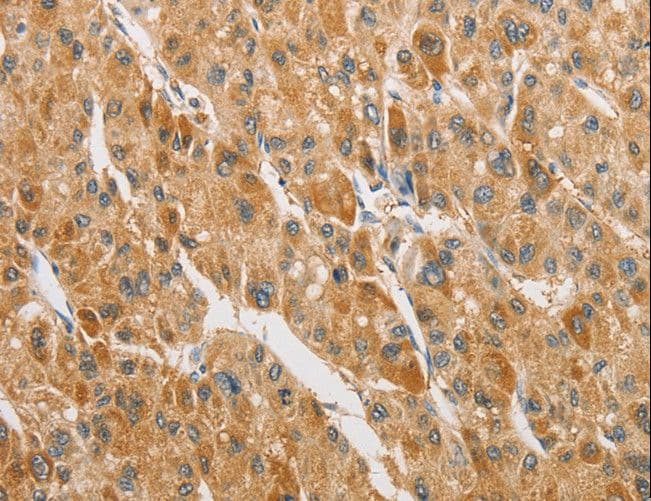 ARHGAP5 / RhoGAP5 Antibody