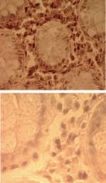 TLR7 / CD287 Antibody (aa706-728, Azide-free)
