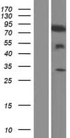 TIAM2 Protein (Over-Expression Lysate Myc-DDK (Flag))