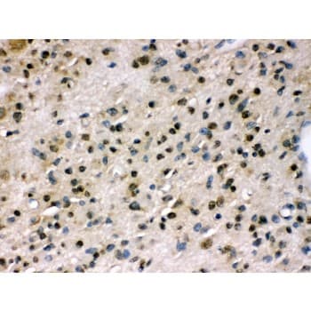 PPP1R12A / MYPT1 Antibody (aa1-40)