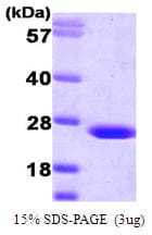 Human GHBP / BLVRB Protein (Recombinant)