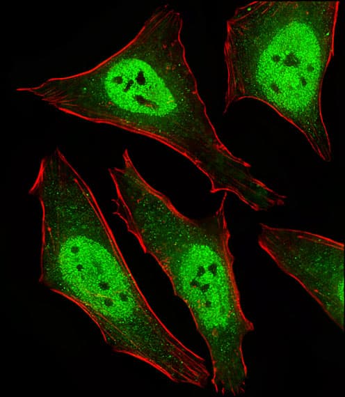MAD2B / REV7 Antibody (aa198-231)