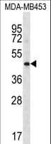 HAPLN3 Antibody (aa102-130)