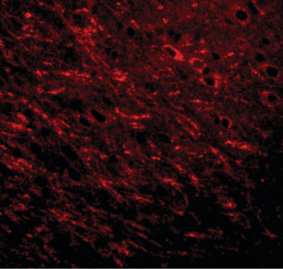 LZTS3 Antibody