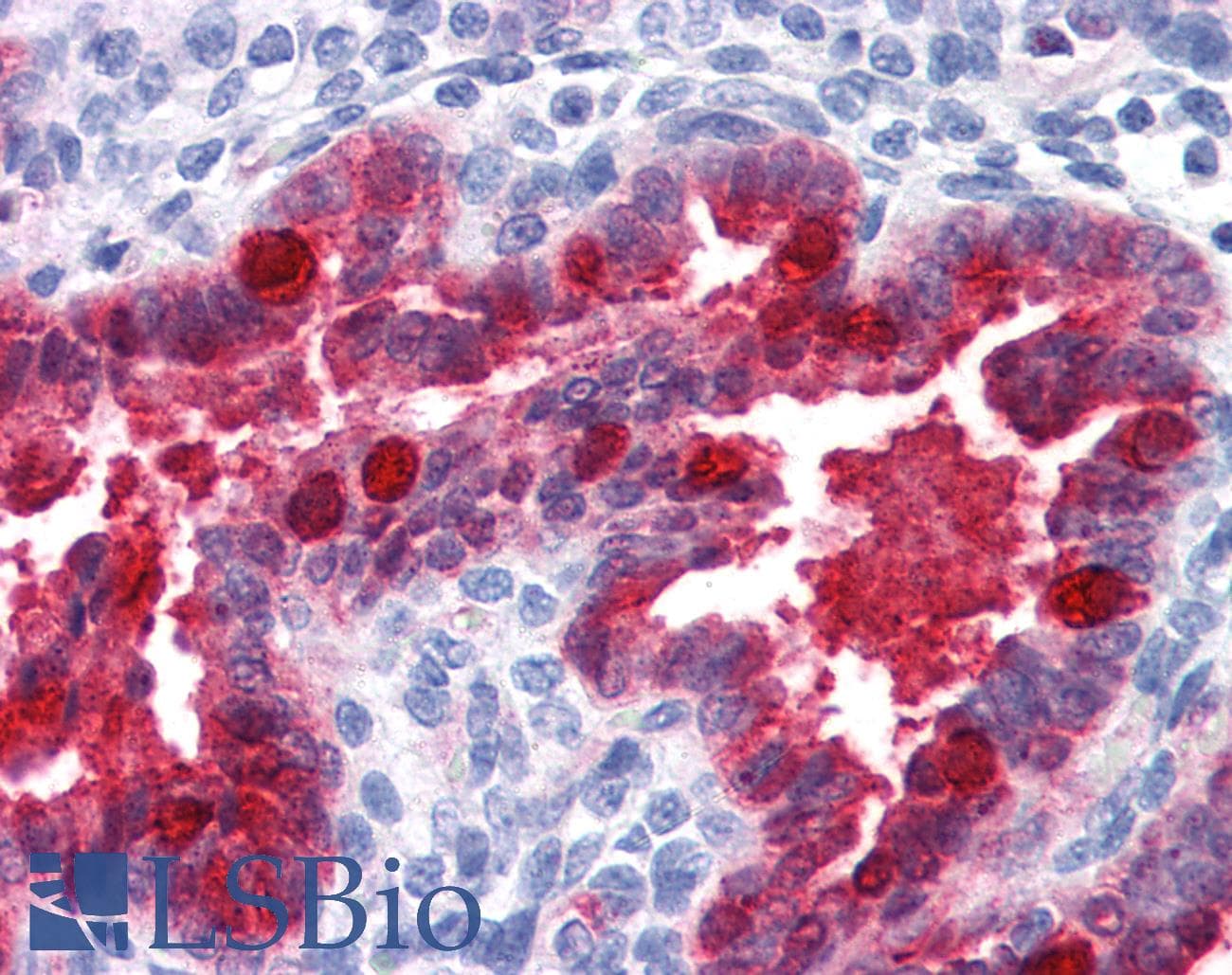 IHC-plus™ NQO1 Antibody (clone AI80)