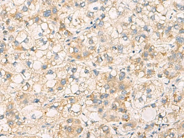 Polyclonal Rabbit anti-Human PAFAH1B3 Antibody (IHC, WB)