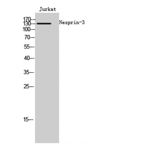 SYNE3 / C14orf49 Antibody (140-220 aa, Internal)