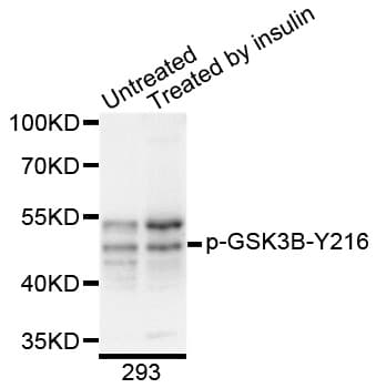 GSK3B / GSK3 Beta Antibody (phospho-Tyr216)