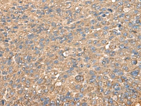Polyclonal Rabbit anti-Human RPS14 / Ribosomal Protein S14 Antibody (IHC, WB)