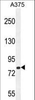WDPCP / FRITZ Antibody (aa676-705)