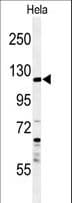 SYTL2 / SLP2 Antibody (aa840-868)
