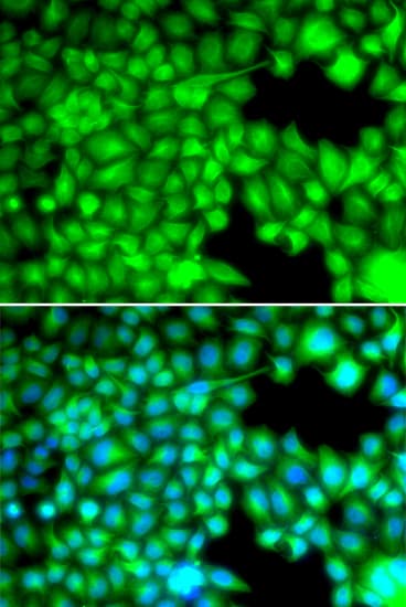 Polyclonal Rabbit anti-Human FABP3 / H-FABP Antibody (IHC, IF, WB)