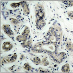 BAD Antibody