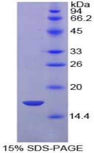 Chicken HIF1A / HIF1 Alpha Protein (Recombinant His)