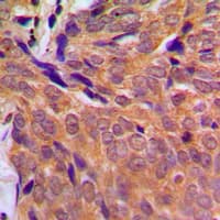 CHEK1 / CHK1 Antibody (Internal)