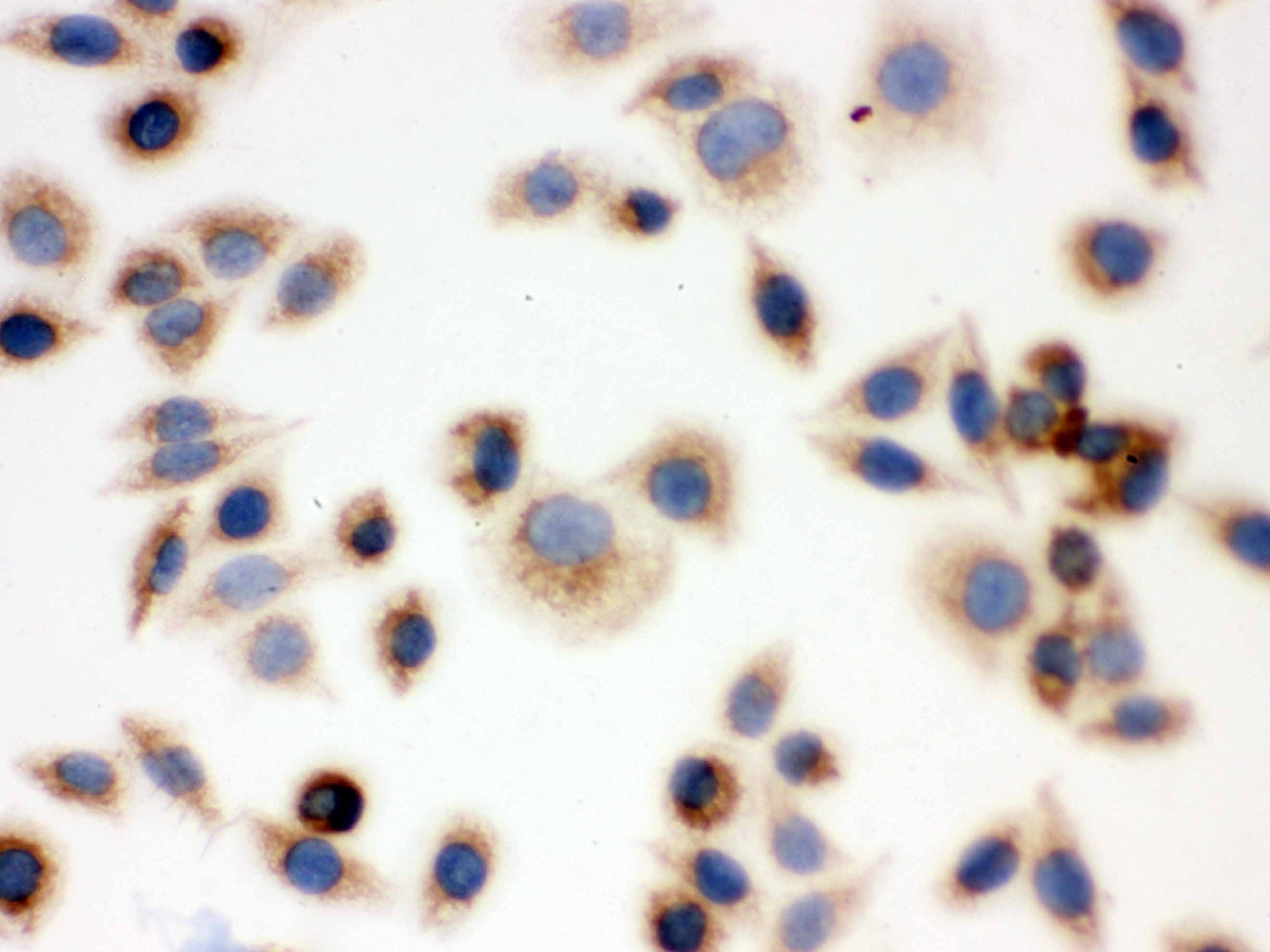 BAK1 / BAK Antibody (aa22-211)