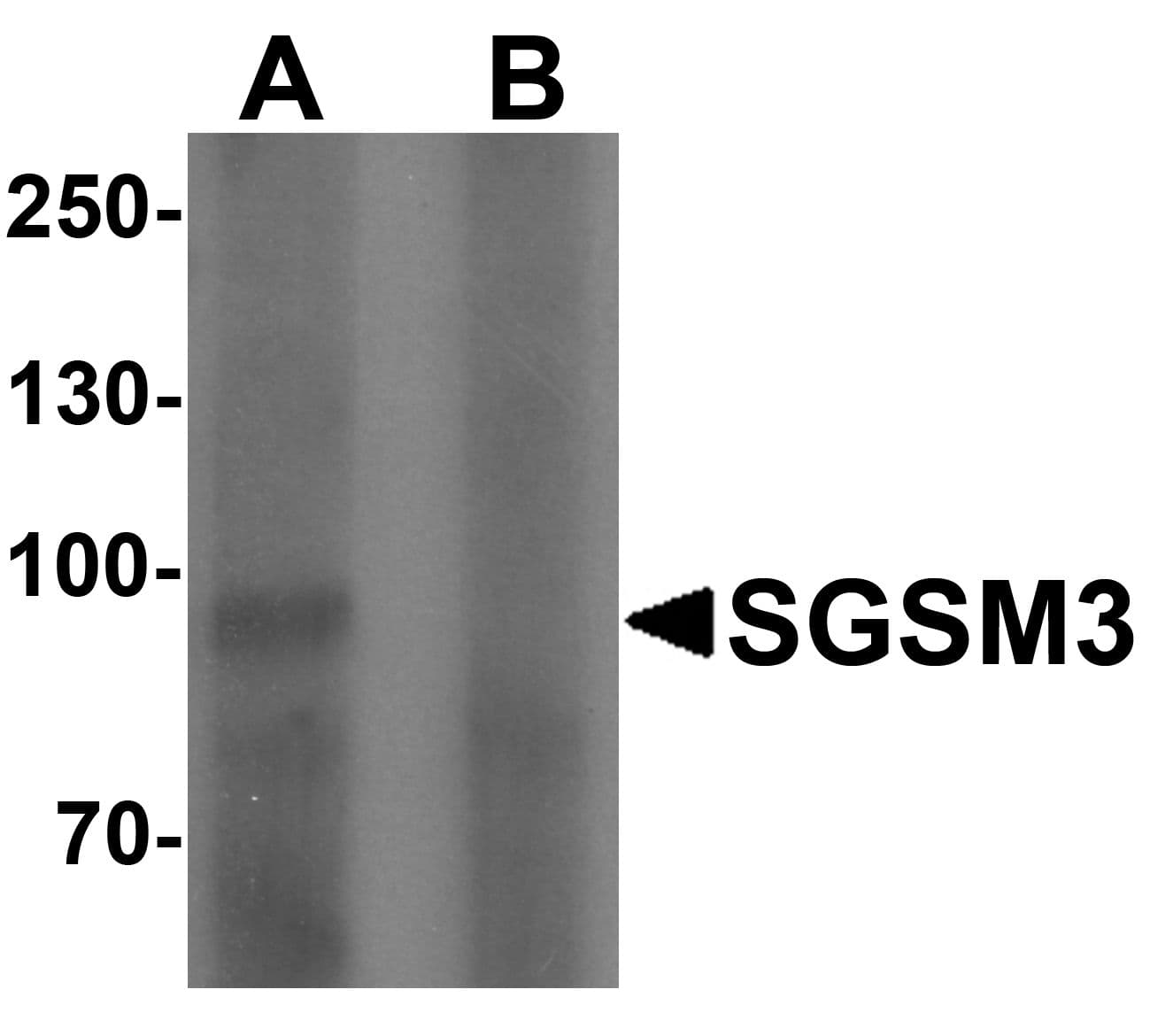 IHC-plus™ SGSM3 Antibody