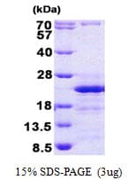 Human CD74 / CLIP Protein (Recombinant His)