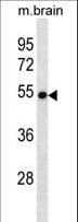 VANGL2 / LTAP Antibody (aa37-65)