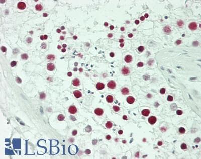 IHC-plus™ Polyclonal Rabbit anti-Human PPM1G Antibody (aa400-450, IHC)