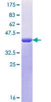 Human CRTC3 Protein (Recombinant GST, N-terminus)