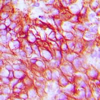 ERBB3 / HER3 Antibody (N-Terminus)