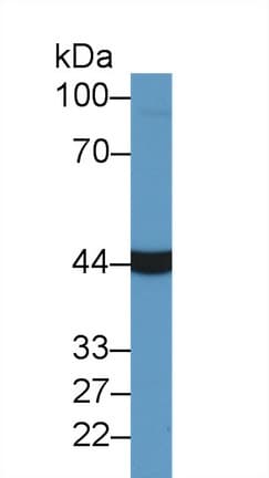 Aspartate Aminotransferase Antibody (aa2-413)
