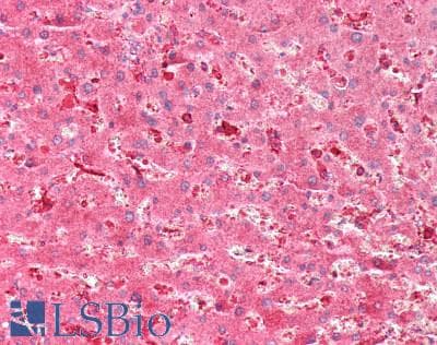 Polyclonal Rabbit anti-Human GBA / Glucosidase Beta Acid Antibody (aa334-498, IHC, WB)