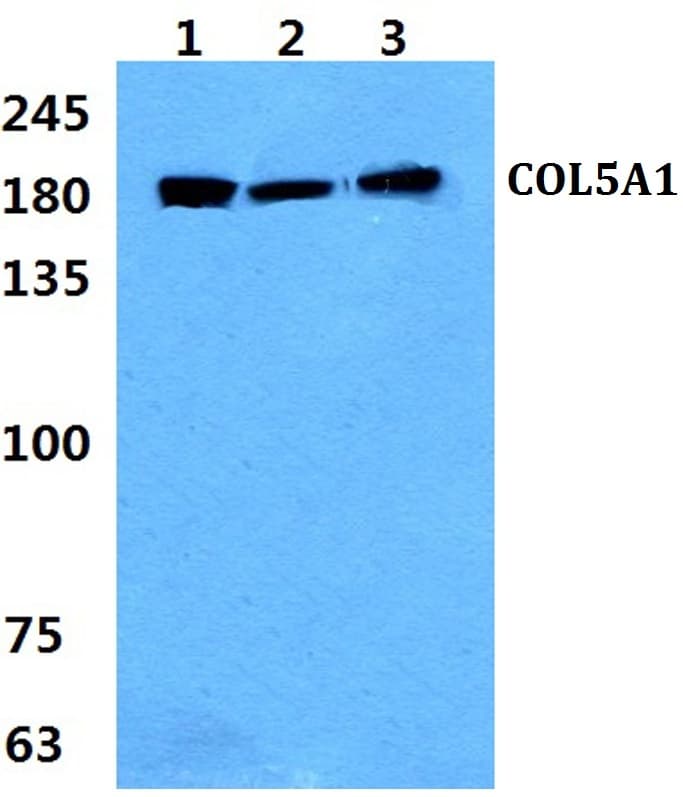 IHC-plus™ Polyclonal Rabbit anti-Human COL5A1 / Collagen V Alpha 1 Antibody (aa300-350, IHC, IF, WB)