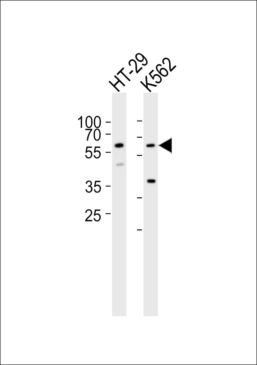 Polyclonal Rabbit anti-Human RIPK3 / RIP3 Antibody (aa61-91, IHC, WB)