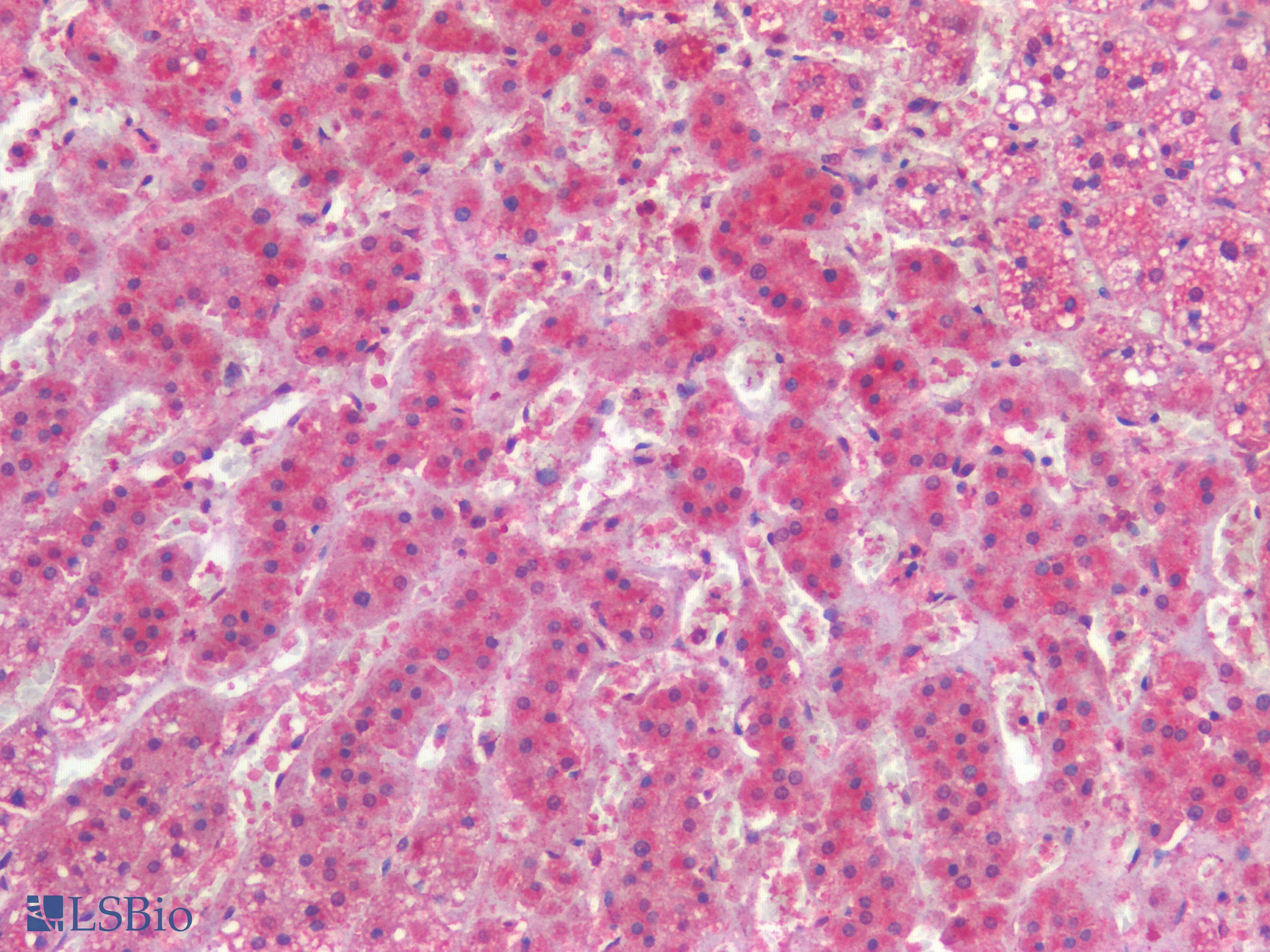 PathPlus™ HAVCR1 / KIM-1 Antibody