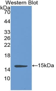 CFB / Complement Factor B Antibody (aa270-388, APC, Cy7)
