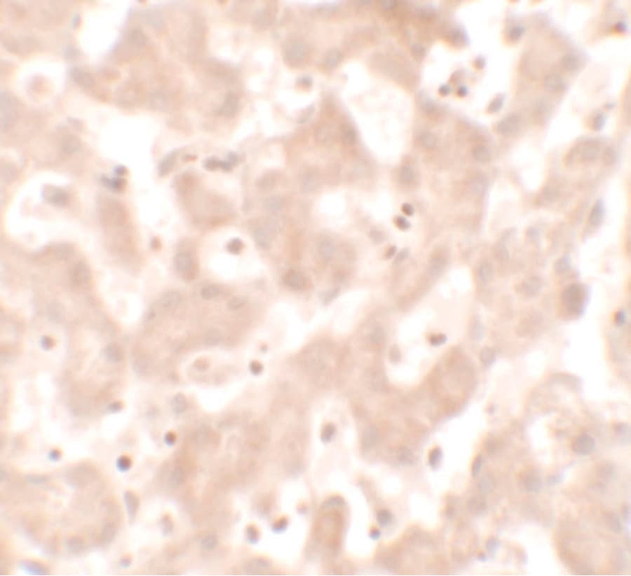 KHDC1 / C6orf148 Antibody