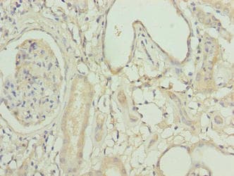 ACSBG1 / hsBG Antibody