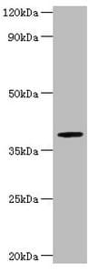 ARSB / Arylsulfatase B Antibody