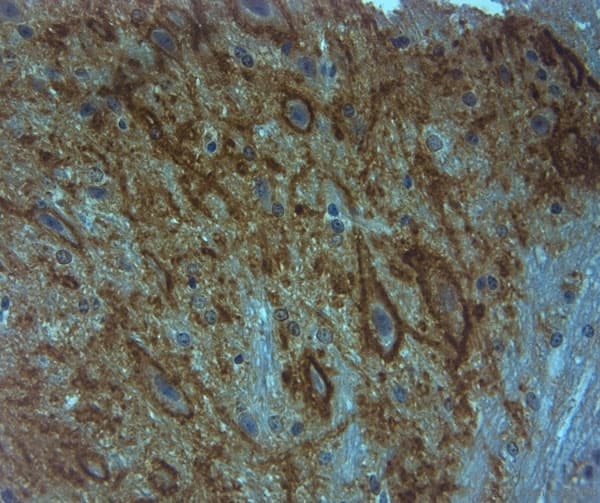 Polyclonal Rabbit anti-Human ACAN / Aggrecan Antibody (aa200-250, IHC)