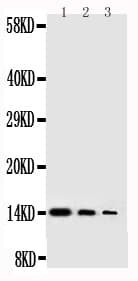 NGF Antibody (aa122-241)