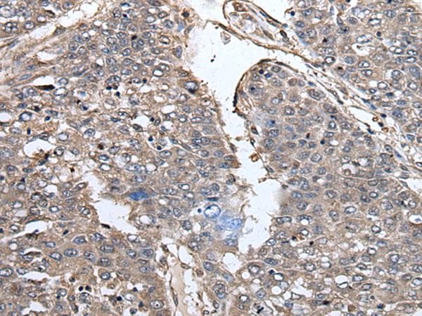 PRUNE Antibody