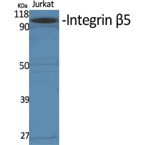 Polyclonal Rabbit anti-Human ITGB5 / Integrin Beta 5 Antibody (690-770 aa, C-terminal, WB)