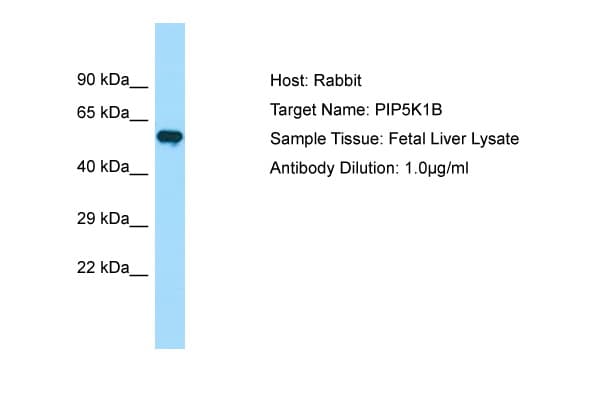 Polyclonal Rabbit anti-Human PIP5K1B Antibody (aa395-444, WB)