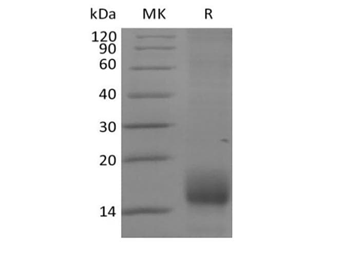Cynomolgus TNFRSF17 / BCMA Protein (Recombinant 6His, C-terminus)