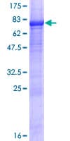 Human LAX1 / LAX Protein (Recombinant GST)