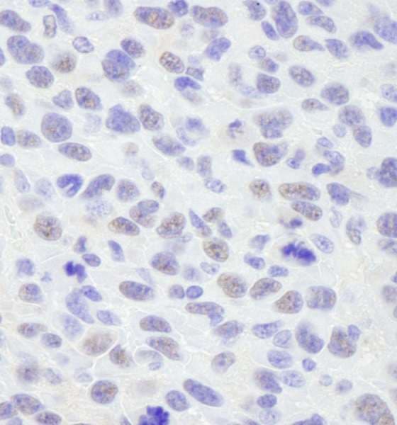 Polyclonal Rabbit anti-Human BANP Antibody (aa425-C-term, IHC)