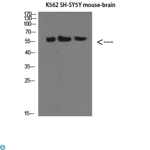 SELE / CD62E / E-selectin Antibody