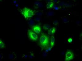 H6PD / G6PDH Antibody (clone OTI2A7)