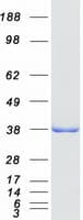 Human ADPRHL2 Protein (Recombinant Myc-DDK (Flag))