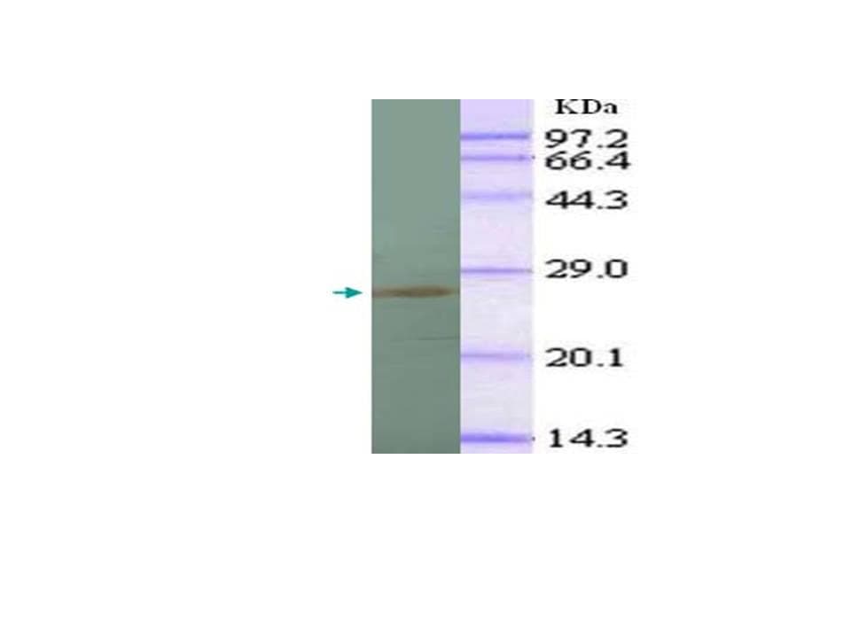 IL1A / IL-1 Alpha Antibody