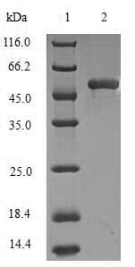 Human DCTN1 / Dynactin 1 Protein (Recombinant 6His-SUMO, N-terminus)