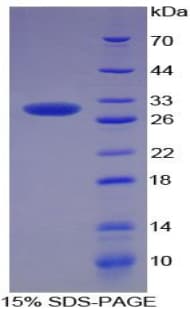 Rat SOD3 Protein (Recombinant His-T7, N-terminus)