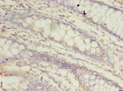 Polyclonal Rabbit anti-Human TRAPPC3 Antibody (IHC)